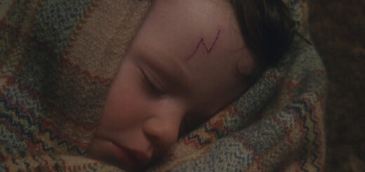 Baby Harry with scar